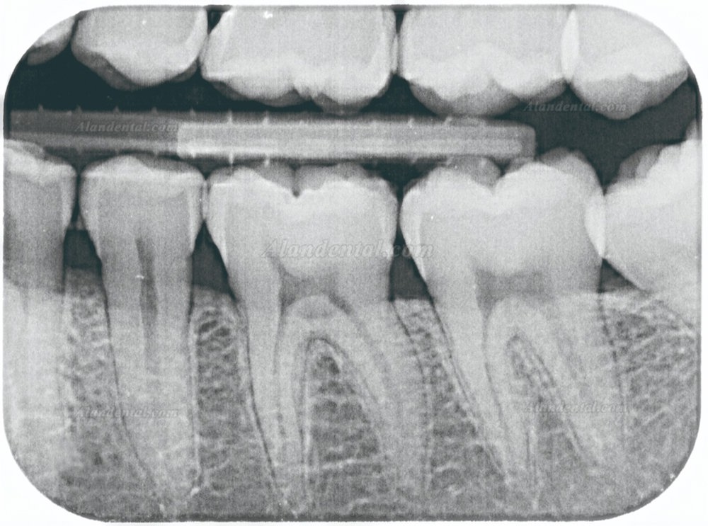 TYRIS TR-120 Dental Image Plate Scanner PSP X ray Scanner